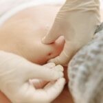Close-up of hands performing acupuncture therapy on a patient's back.