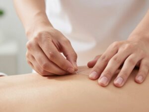 Dry needling trigger point therapy at Quantum Physio HSR Layout