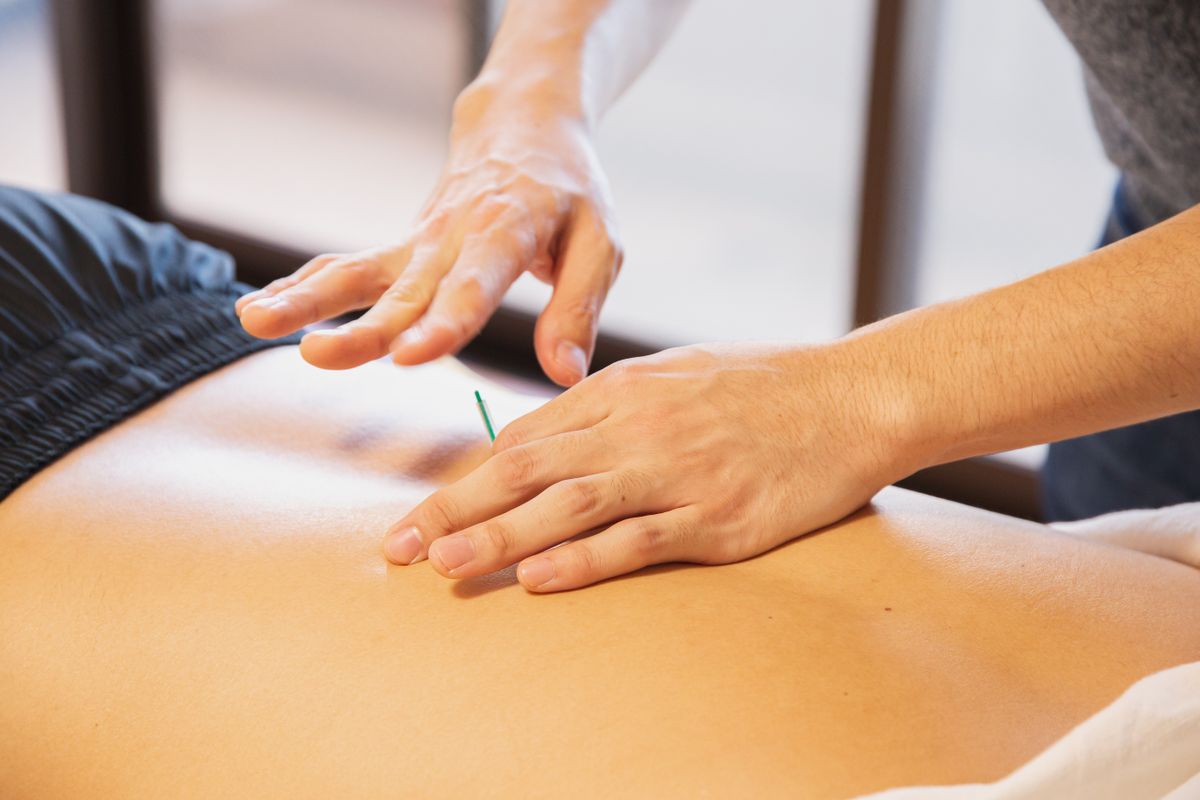 Patient performing early ACL rehabilitation exercises with physiotherapist in Akshayanagar Bangalore